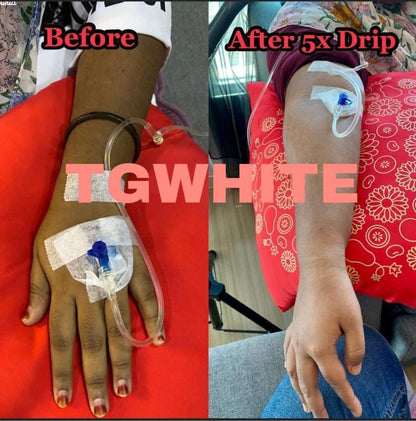 TG White Injection